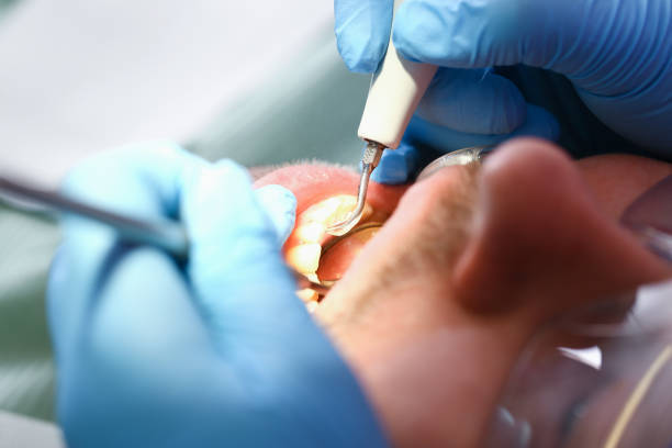 Best Emergency Denture Repair in Hlside, IL